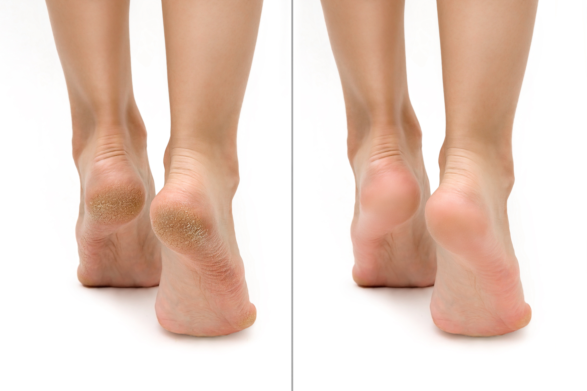 Before-After-Pedicure-Foot-Stock-Photo