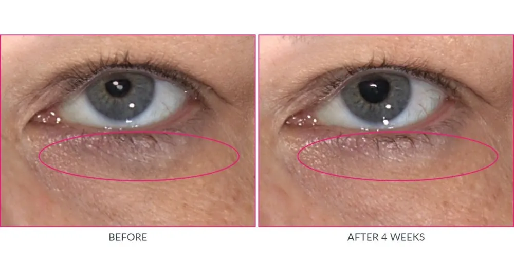 Kate Somerville Wrinkle Warrior Eye Gel