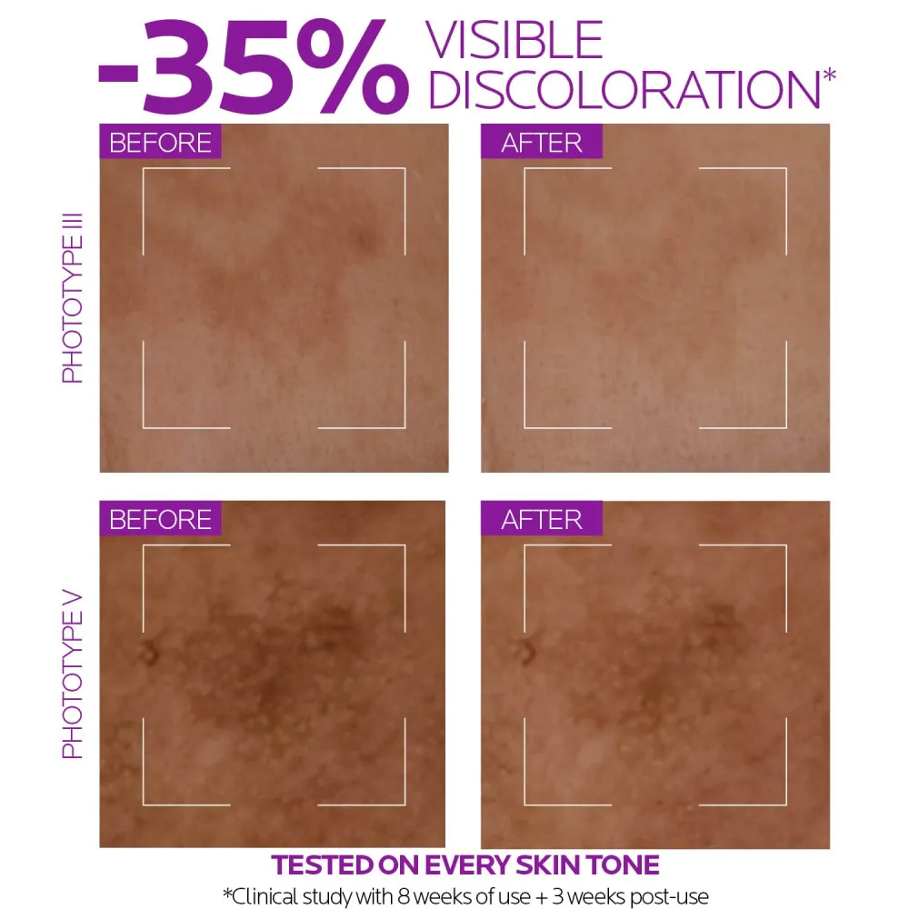 La Roche Posay Niacinamide 10 Face Serum