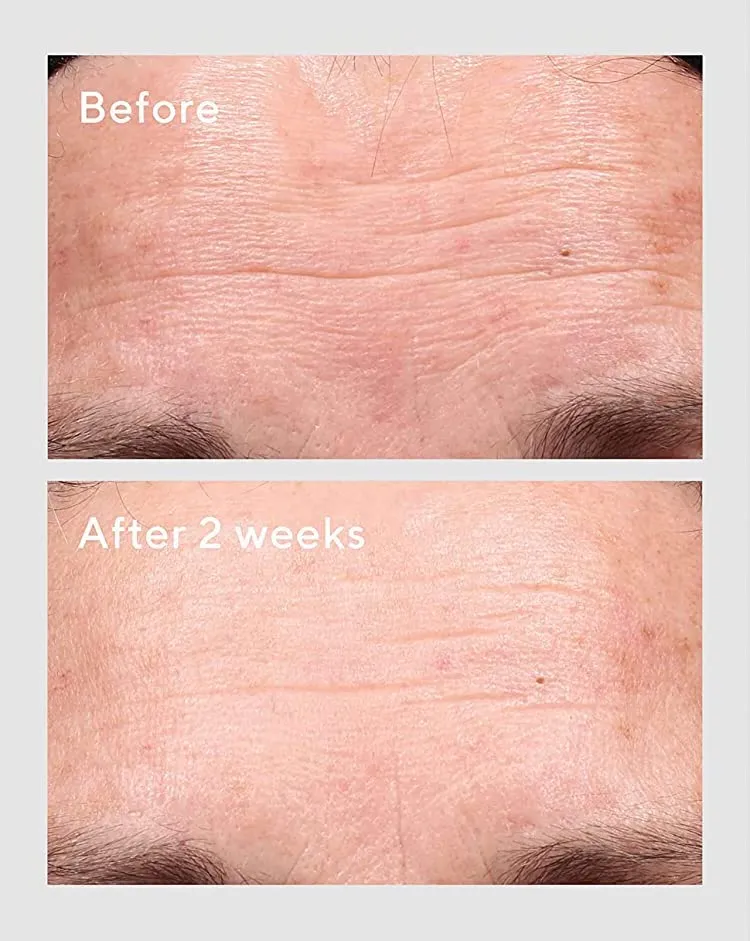 Murad Retinol Youth Renewal Serum