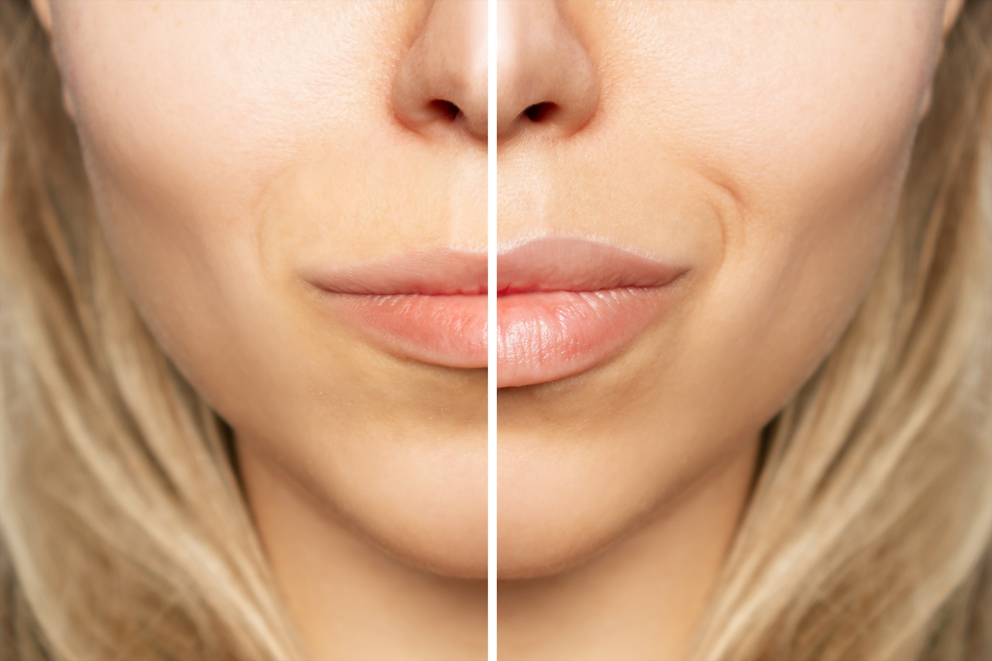 Plup-Lips-Before-After-Stock-Photo