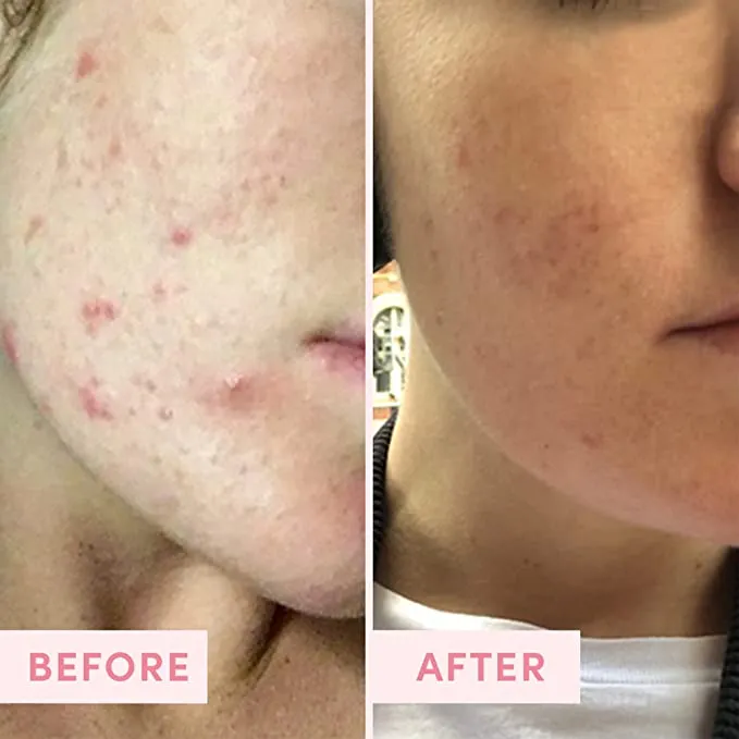 Sand & Sky Australian Pink Clay Porefining Mask