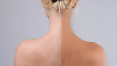 Self-Ran-Before-After-Results-Stock-Photo