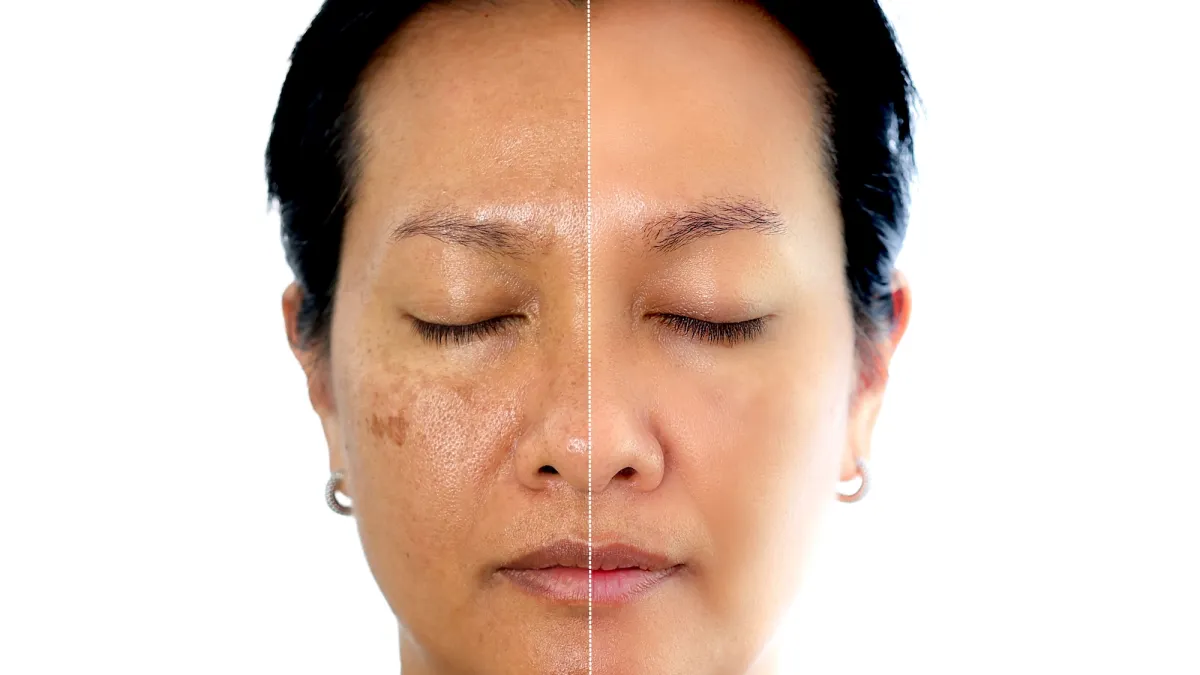 Skin-Discoloration-Before-After-Stock-Photo