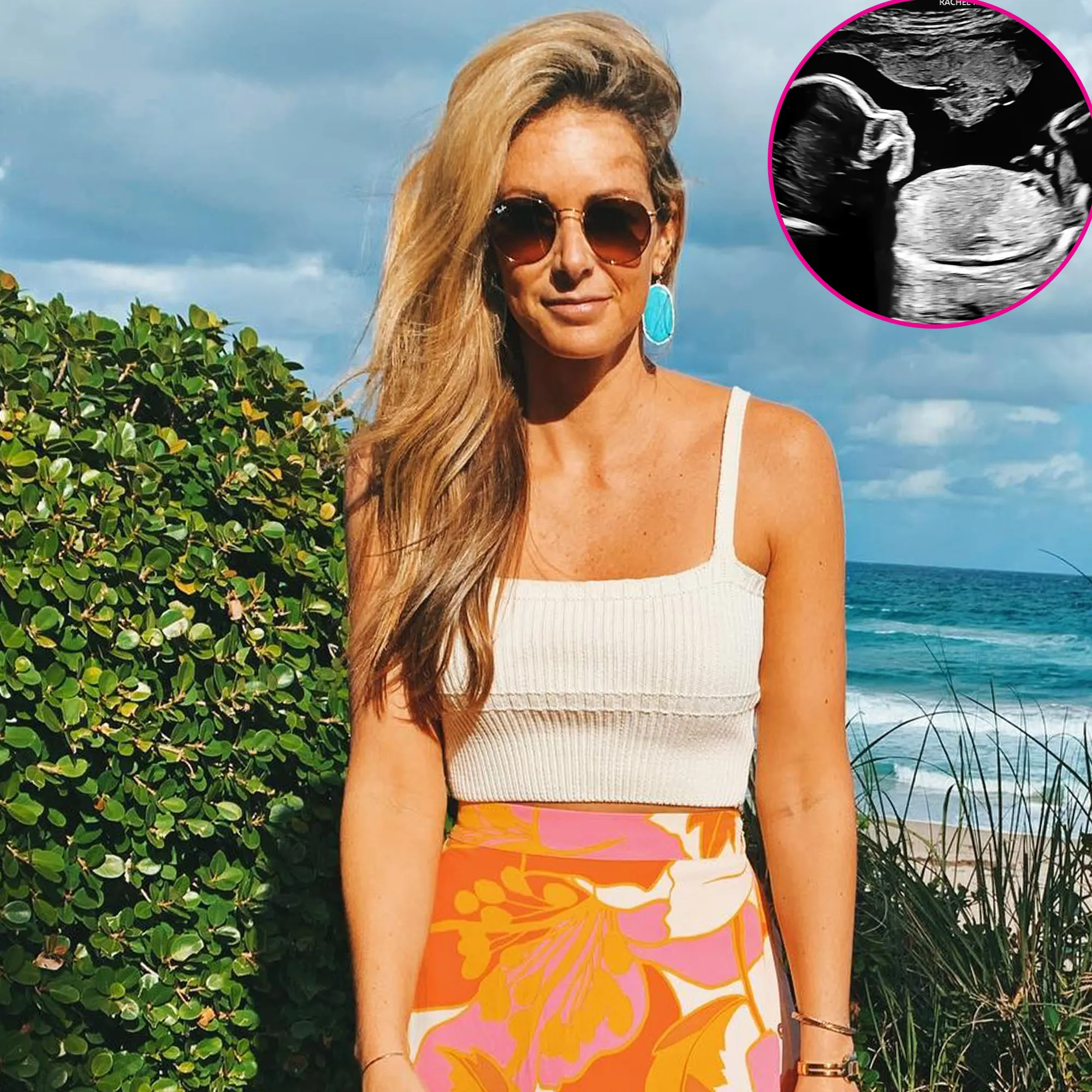 'Southern Charm' Alum Chelsea Meissner is Pregnant With Her 1st Child: 'The Circle of Life is a Powerful Thing'