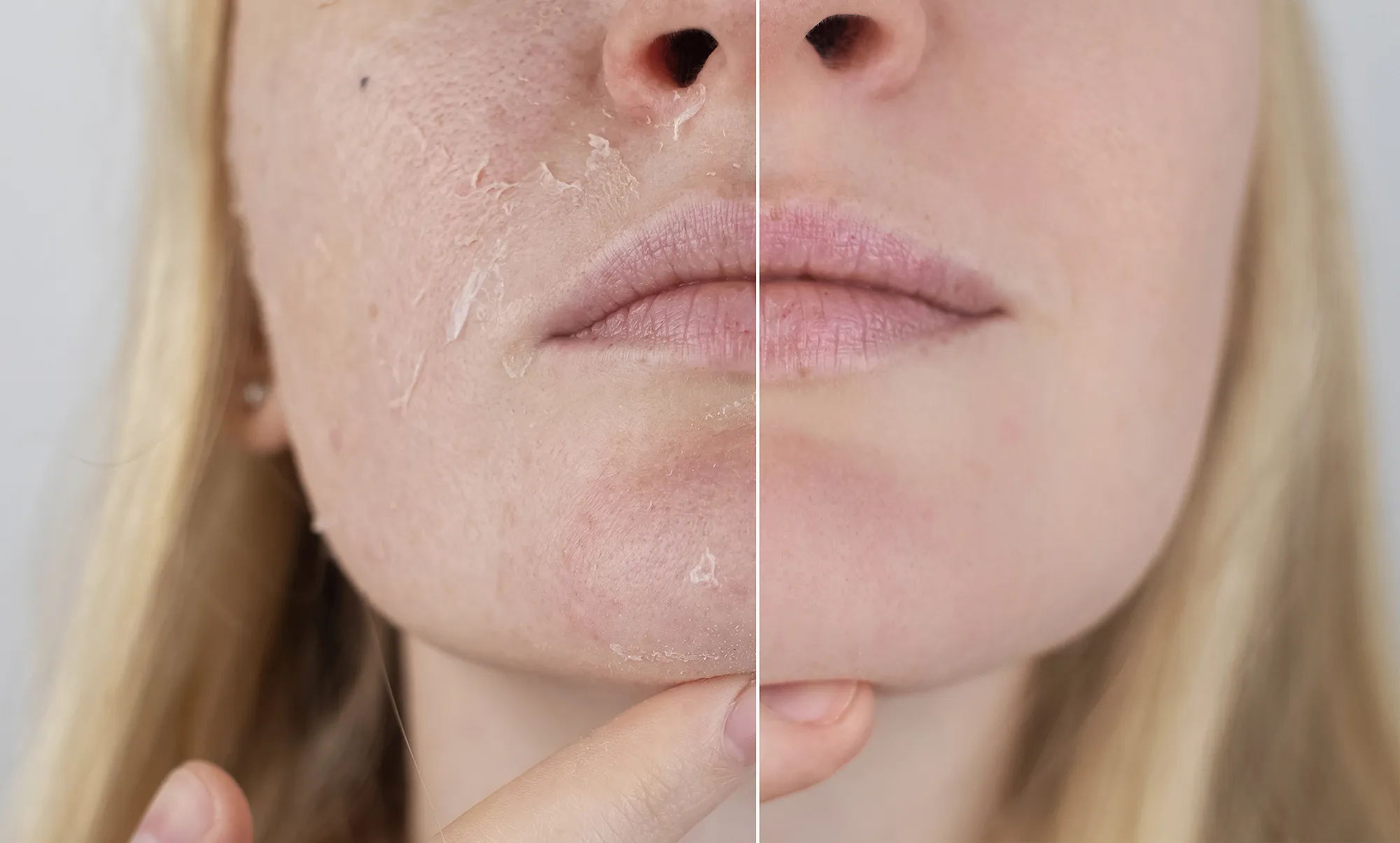 amazon-la-roche-posay-ultra-fine-face-scrub