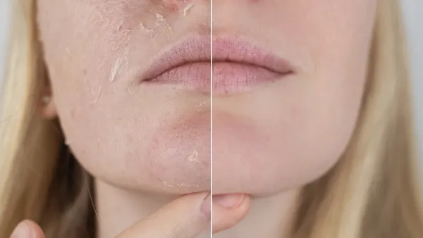 amazon-la-roche-posay-ultra-fine-face-scrub