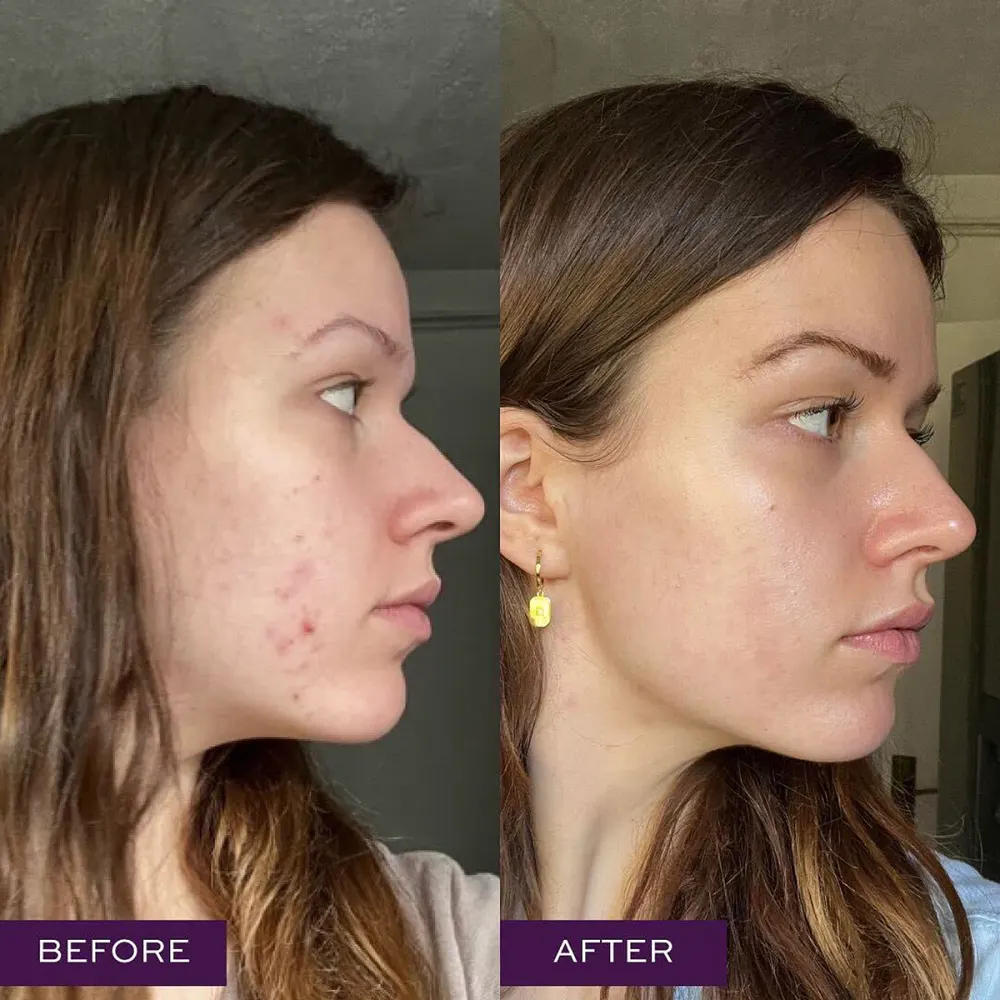 know-beauty-clay-mask-before-after