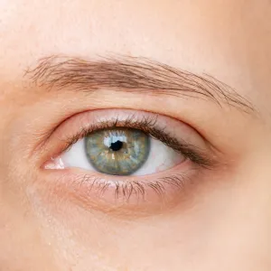 Dark-Circle-Before-After-Closeup-Stock-Photo