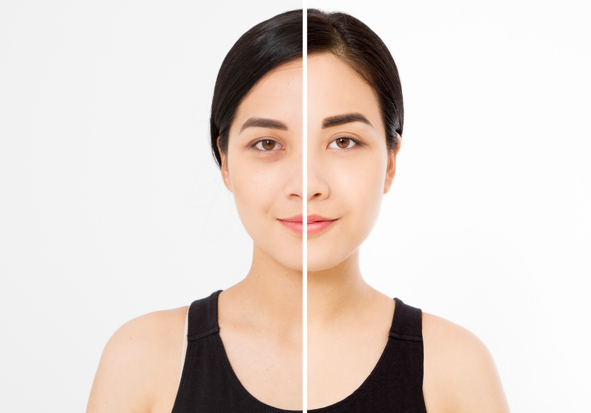 Dark-Circle-Before-After-Stock-Photo