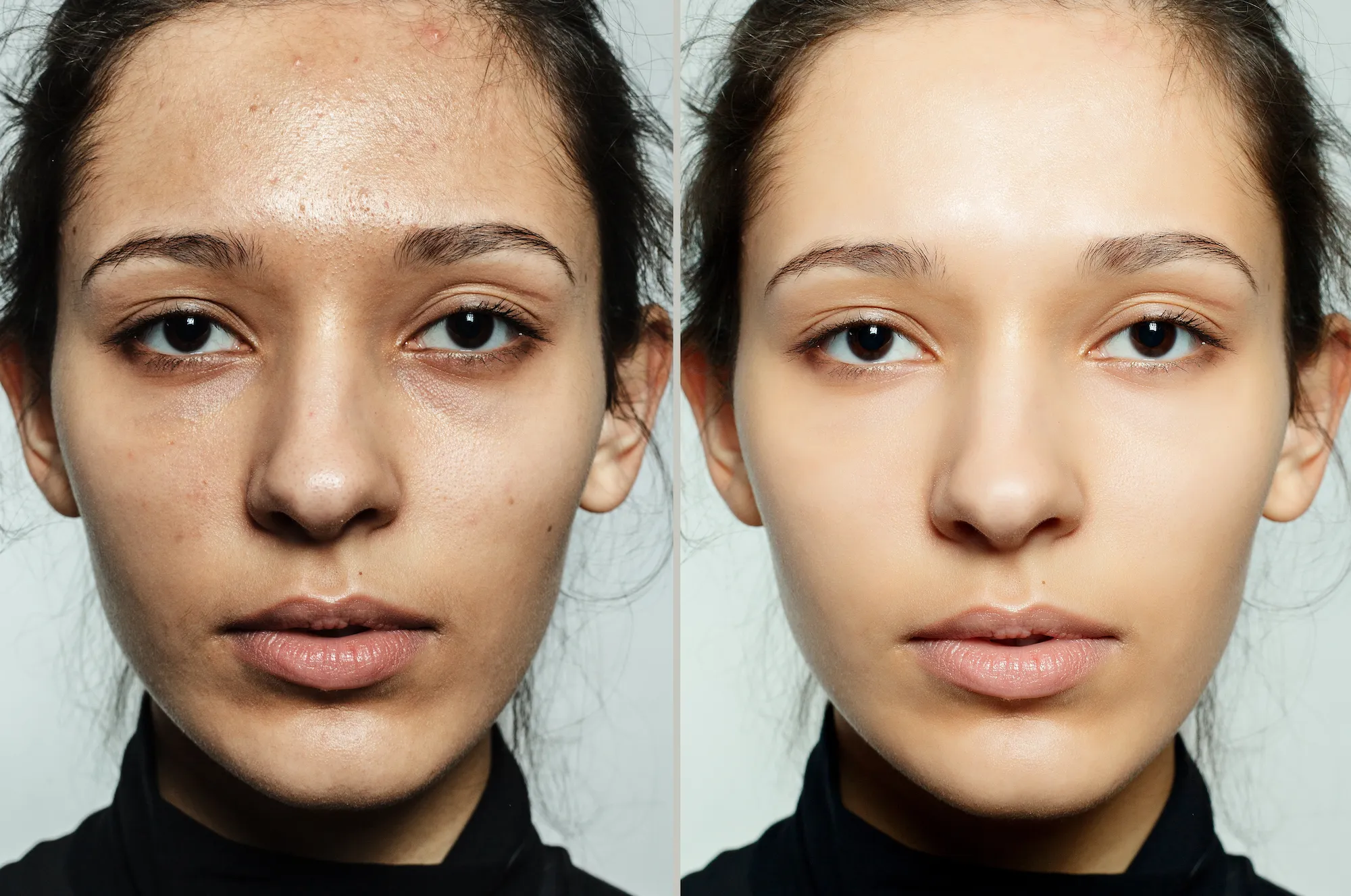 Skin-Close-Up-Before-After-Shot-Stock-Photo