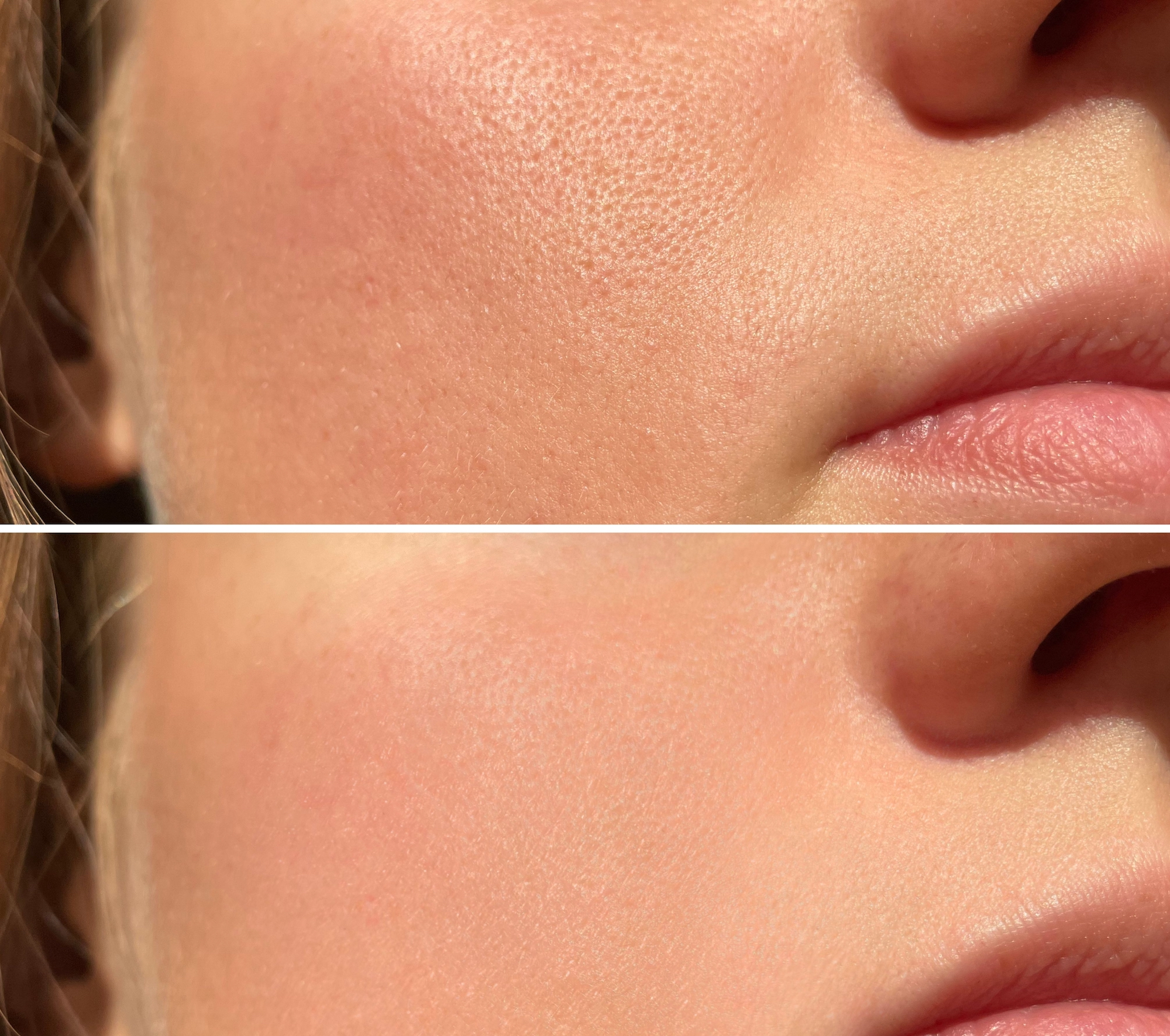 Skin-Pores-Bfore-After-Stock-Photo