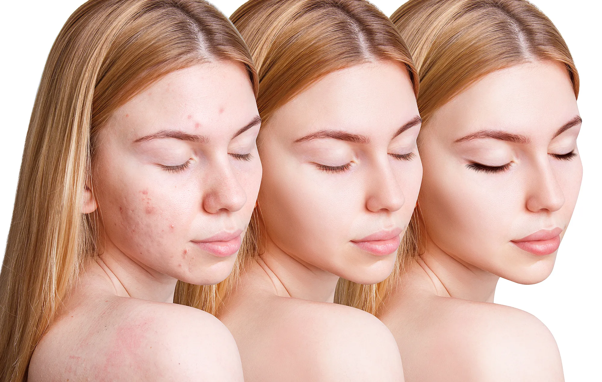 amazon-beauty-patchology-breakout-box