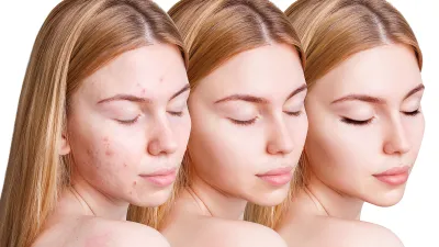 amazon-beauty-patchology-breakout-box