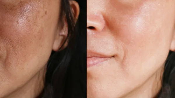 amazon-goodal-vitamin-c-serum