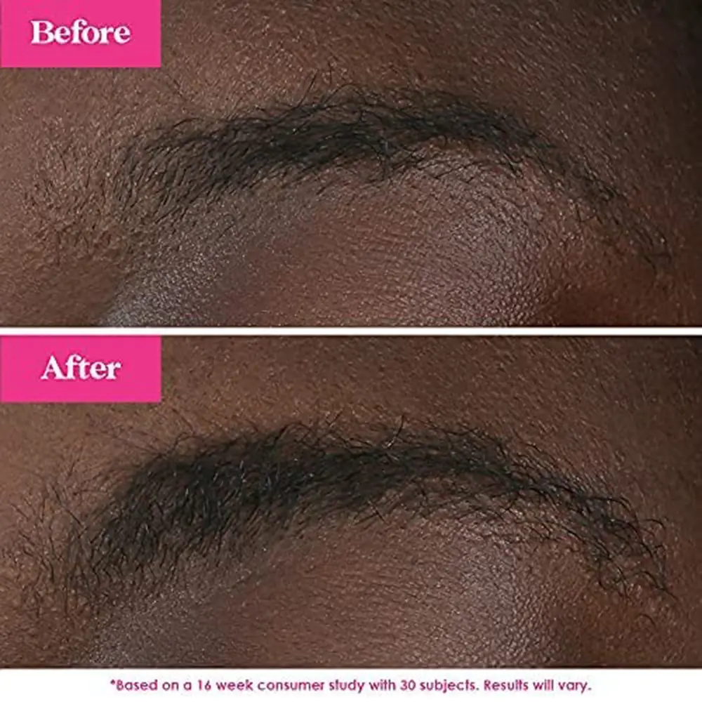amazon-grandebrow-enhancing-serum-before-after