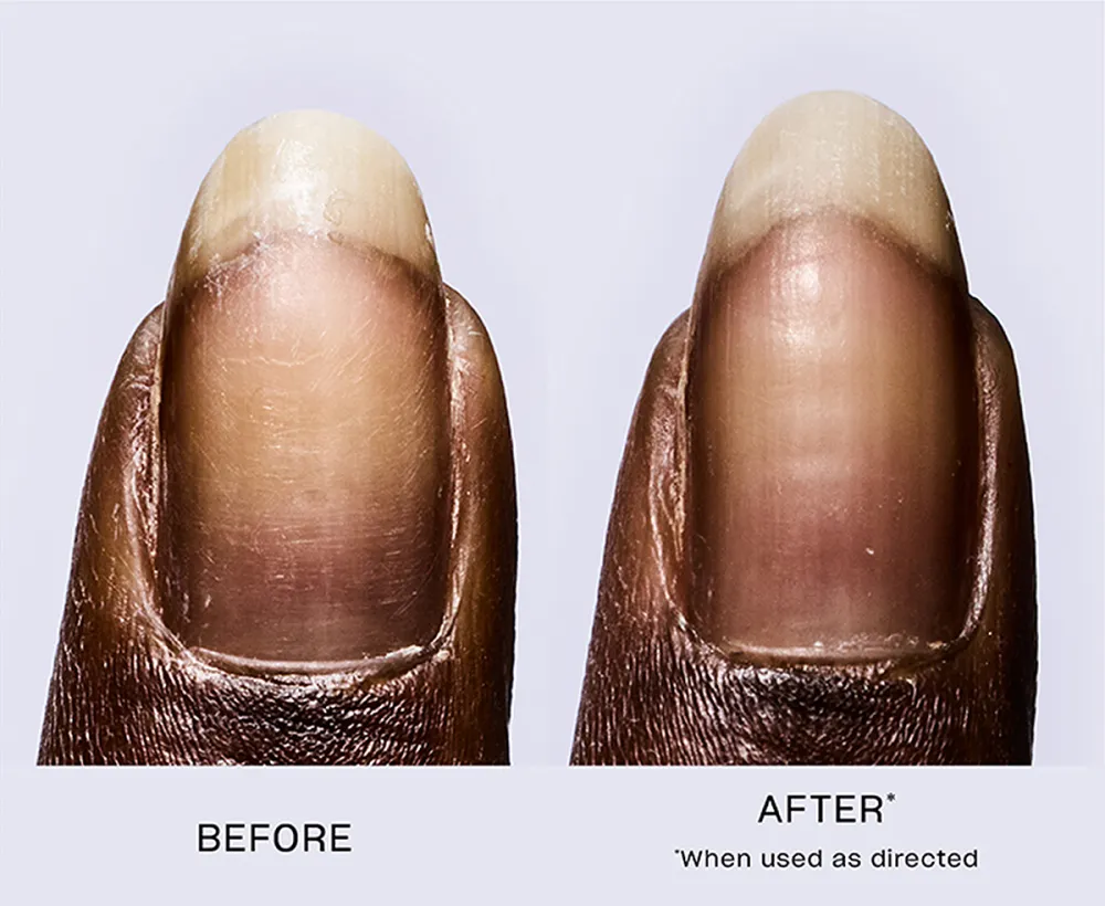 amazon-opi-repair-mode-before-after