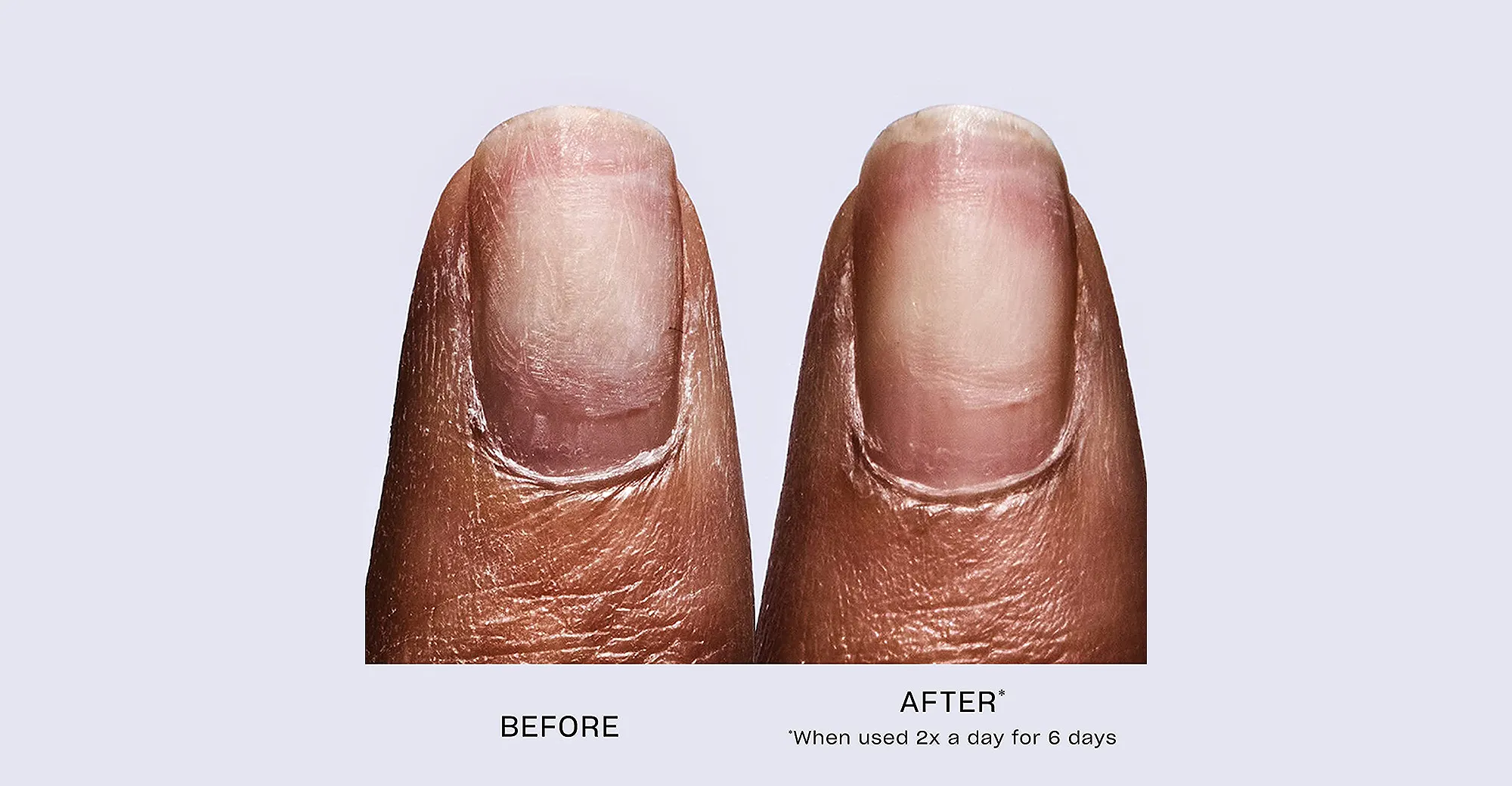 amazon-opi-repair-mode-nail-serum