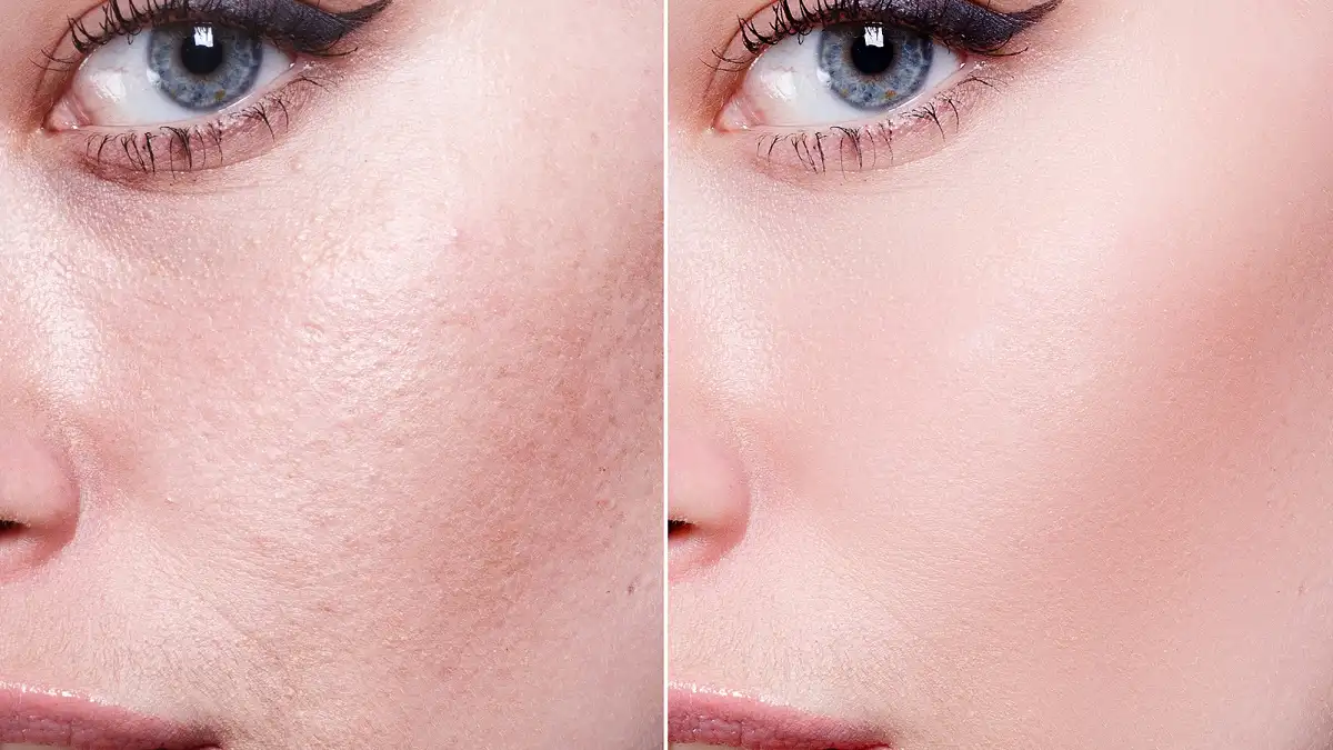 amazon-vichy-double-glow-peel-mask