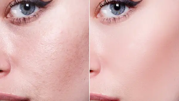 amazon-vichy-double-glow-peel-mask