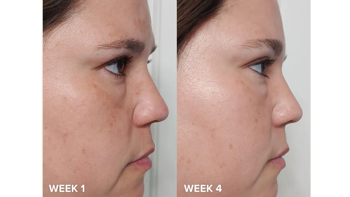 Paula's Choice exfoliant before and after