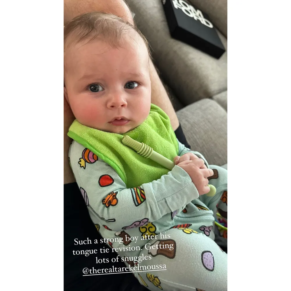 Heather Rae and Tarek El Moussa Son Tristan Undergoes Tongue Tie Revision 3