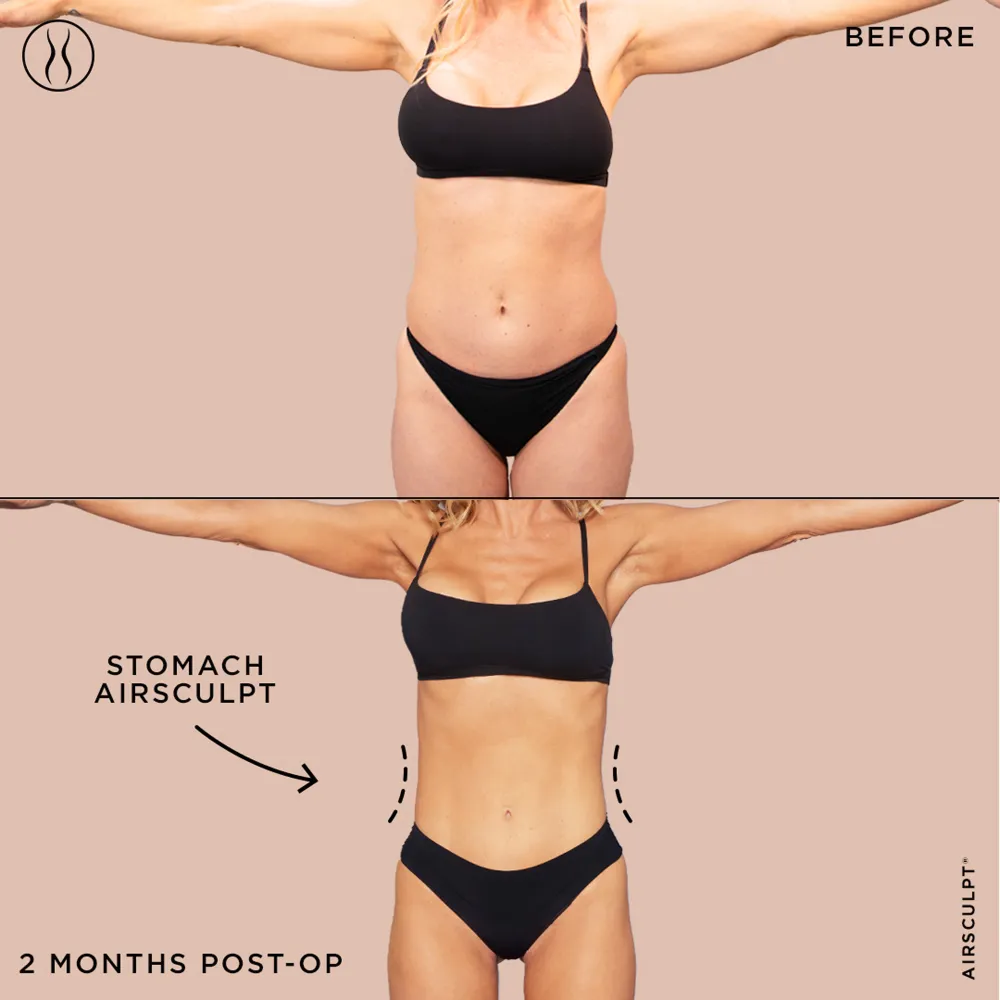 Jenny McCarthy Explains Why Doesnt Own a Scale or Use Ozempic