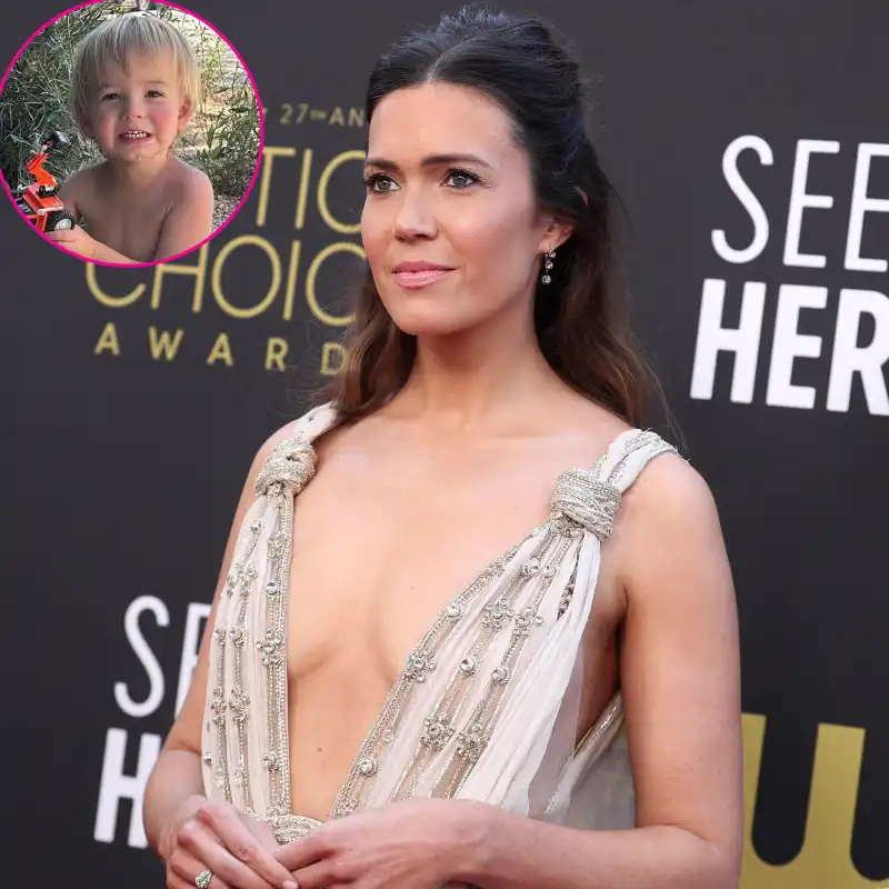Mandy Moore's Reveals Son Gus Rare Skin Condition