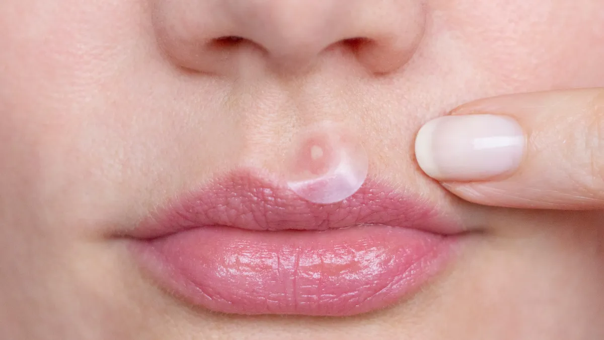 Pimple-Patch-Stock-Photo