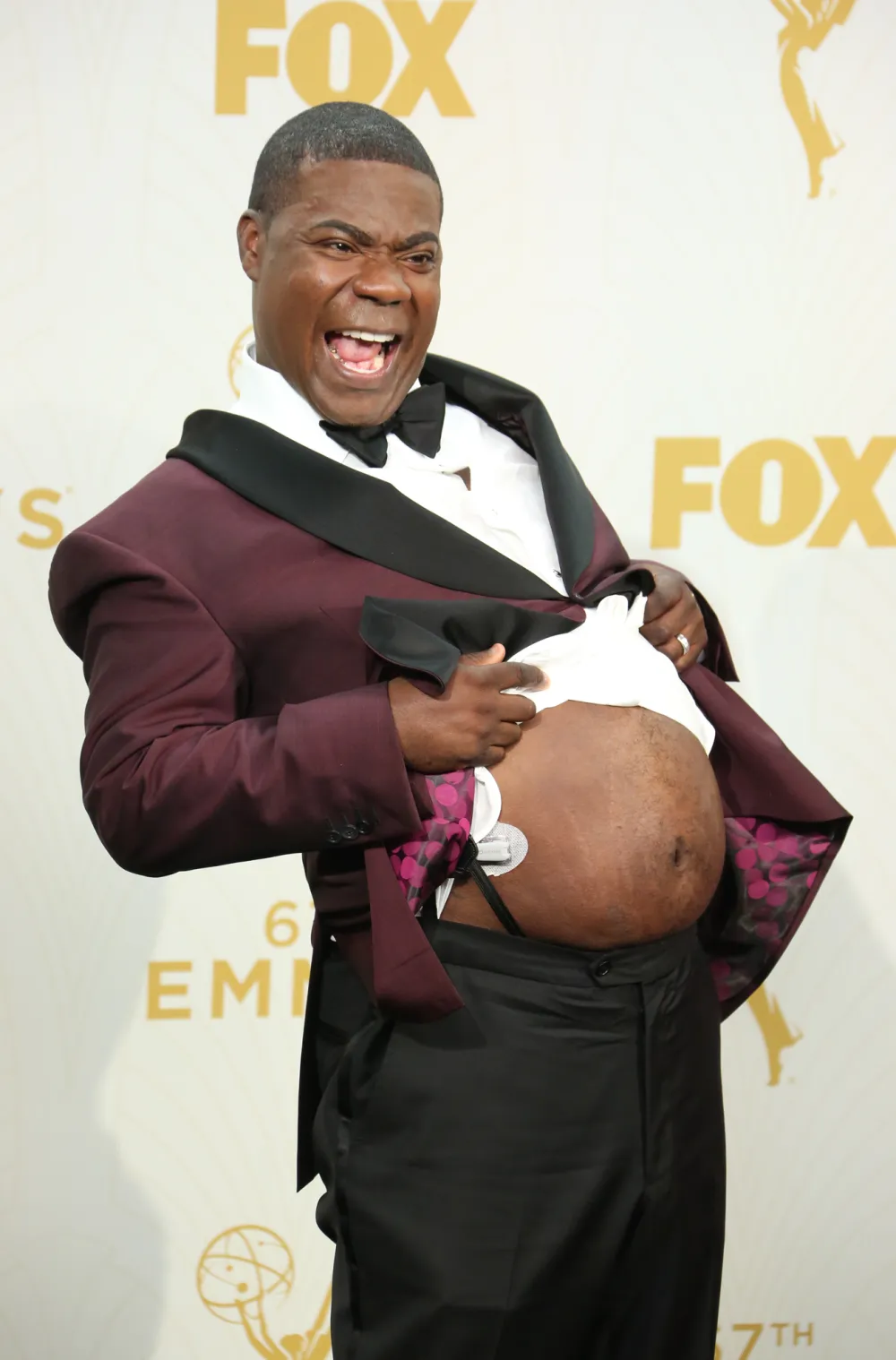 Tracy Morgan Attributes His Weight Loss to Using Ozempic