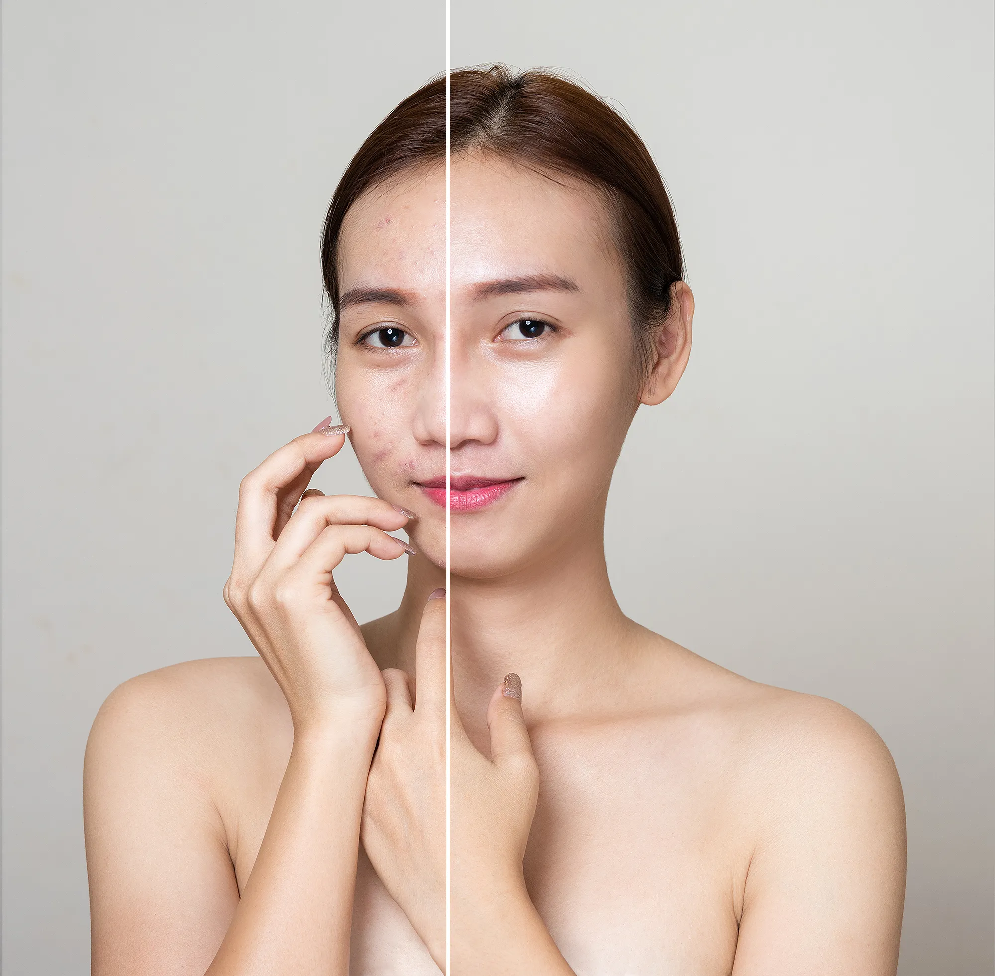 amazon-bee-rx-blemish-repair