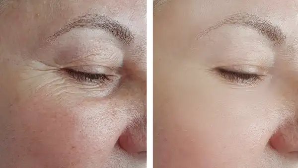 wealthskin-eye-serum-amazon-beauty