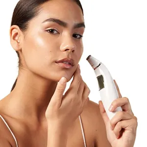 Exfora Facial Microdermabrasion Wand by Vanity Planet