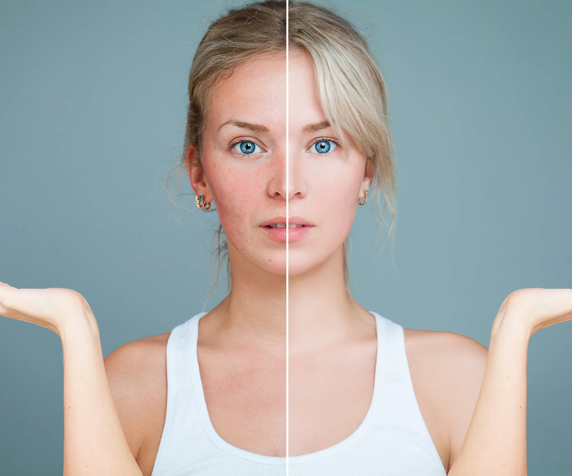 amazon-embryolisse-cream