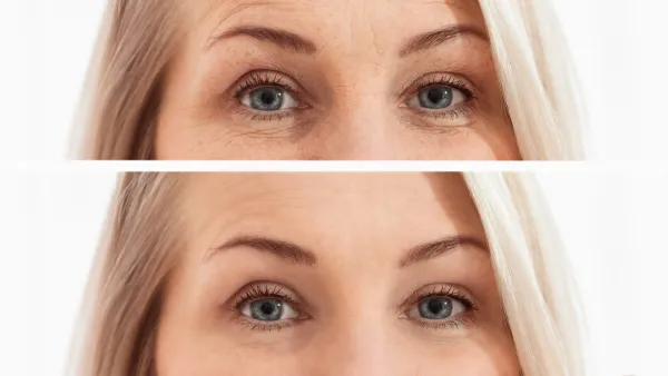 eye cream before and after