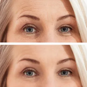 eye cream before and after