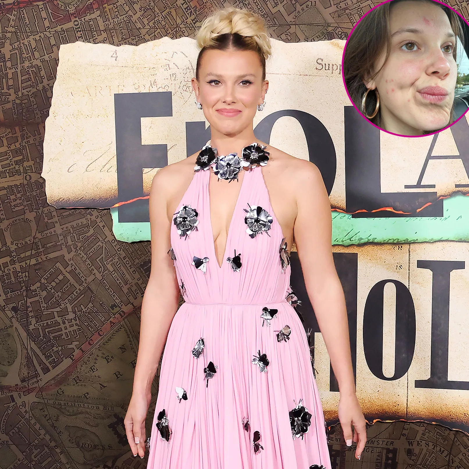 Promo Millie Bobby Brown Shares Relatable Makeup-Free Snap of Her Acne