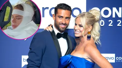 Caroline Stanbury Husband Reacts to Facelift