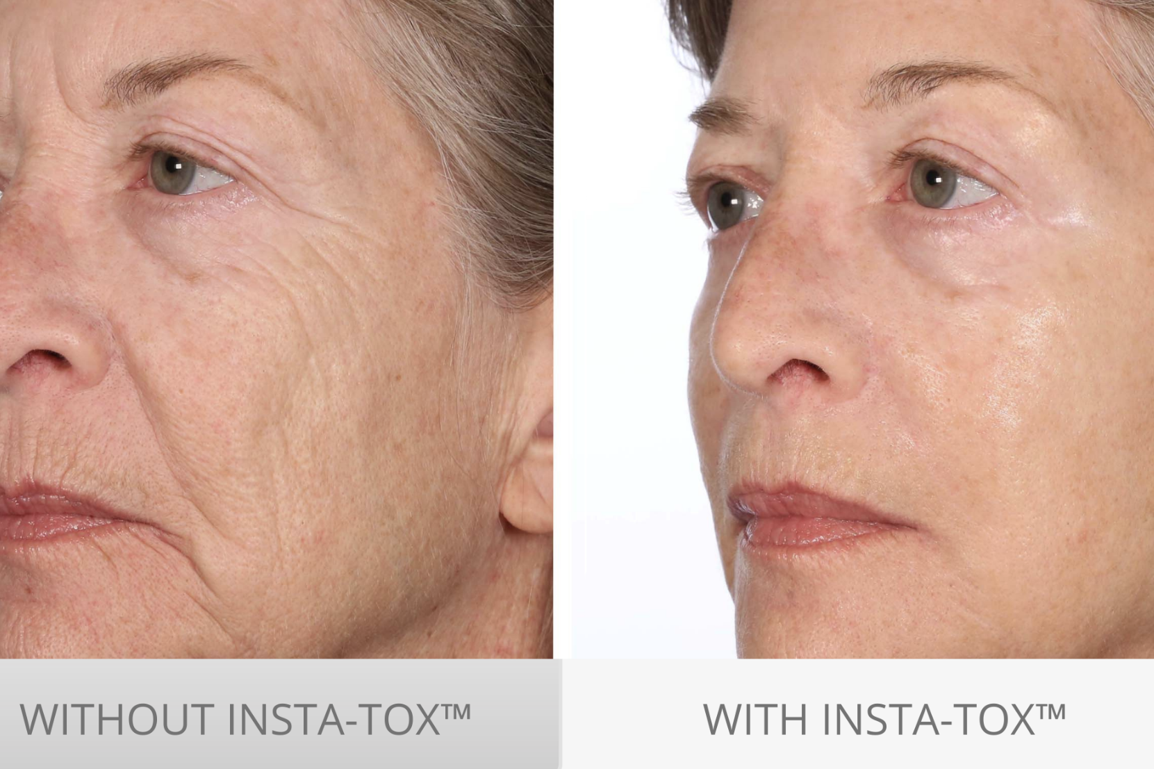 Serious Skincare InstaTox