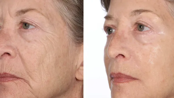 Serious Skincare InstaTox