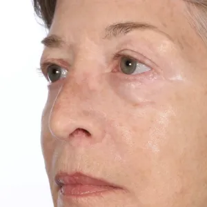 Serious Skincare InstaTox