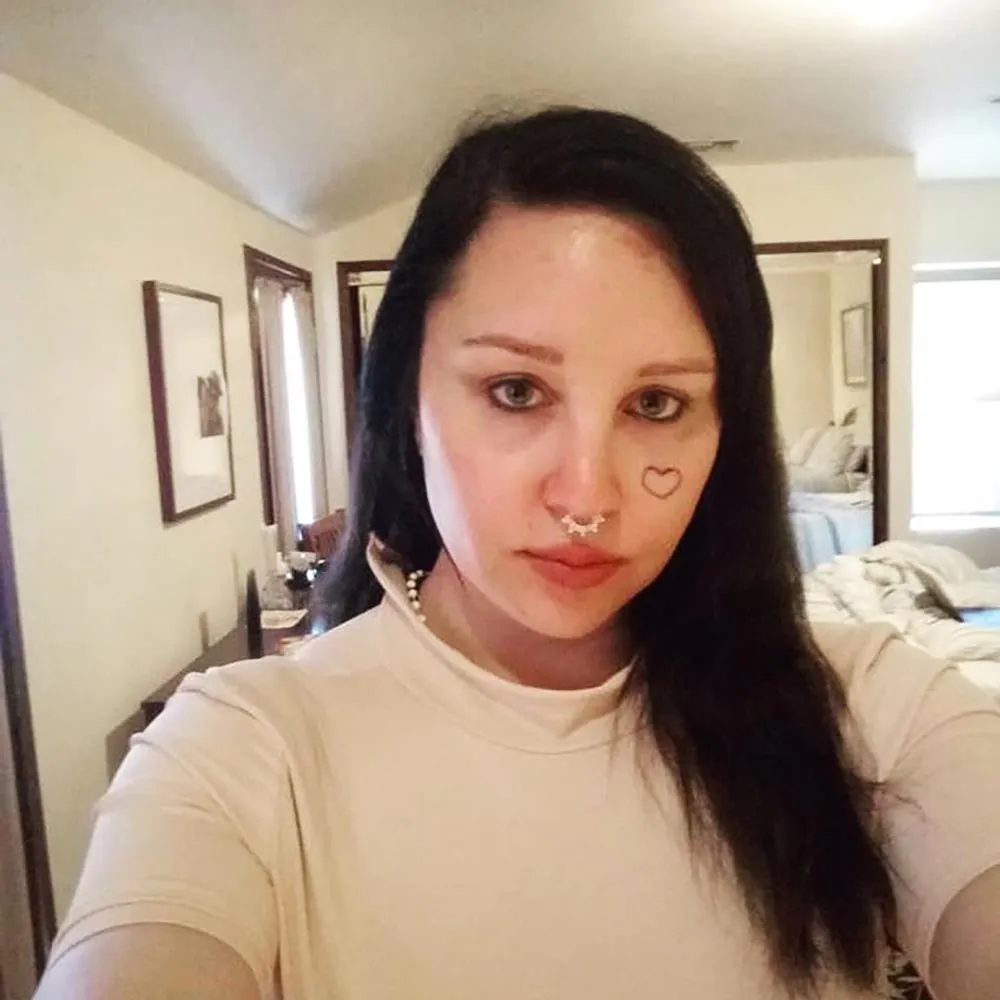 Amanda Bynes Says Blepharoplasty Procedure Made Her &lsquo;Feel a Lot Better&rsquo; in Her Skin