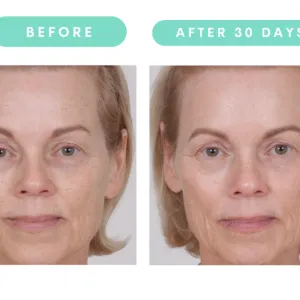 Serious Skincare
