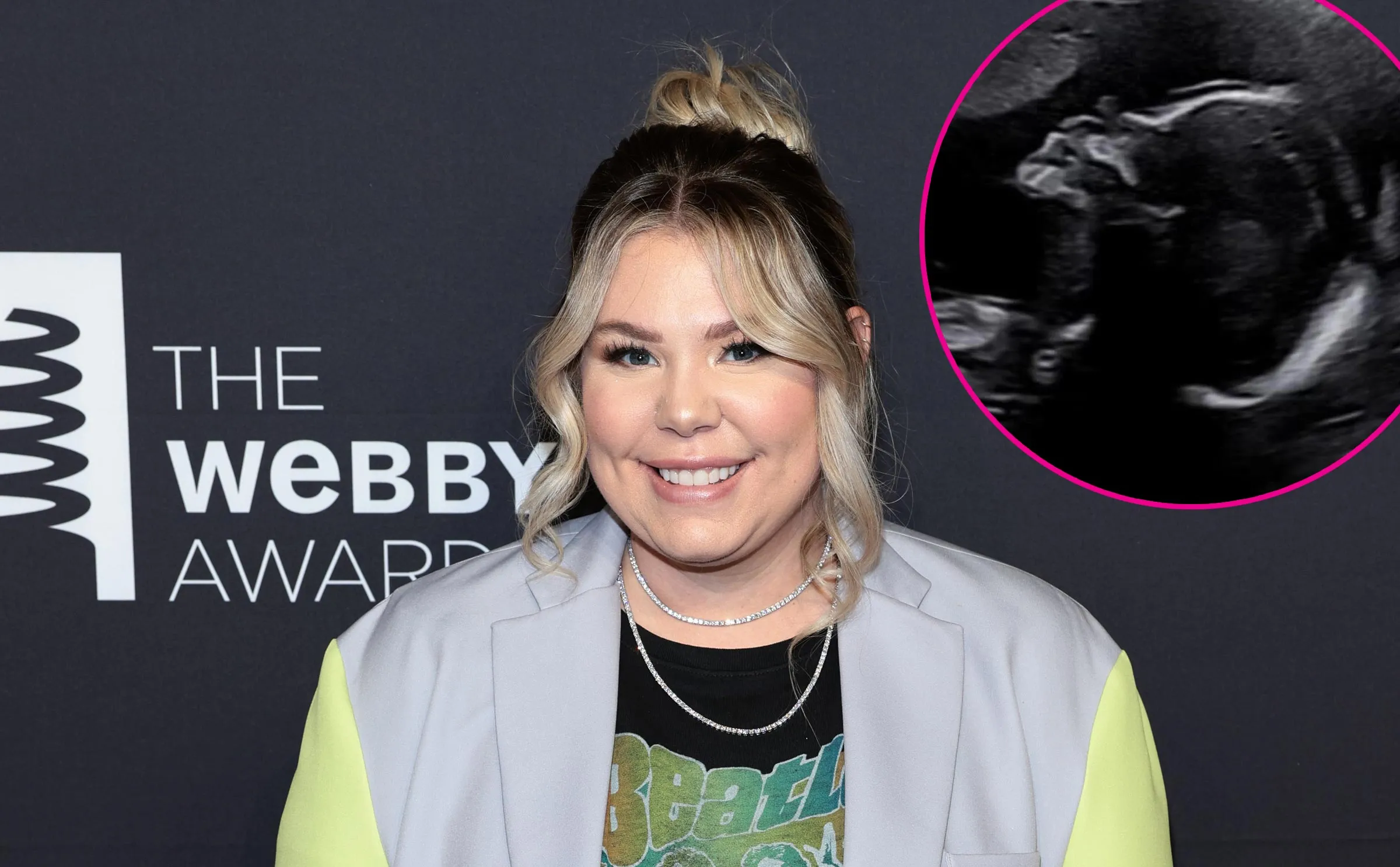 Pregnant Kailyn Lowry Shows Baby Bump Evolution While Expecting Twins 927