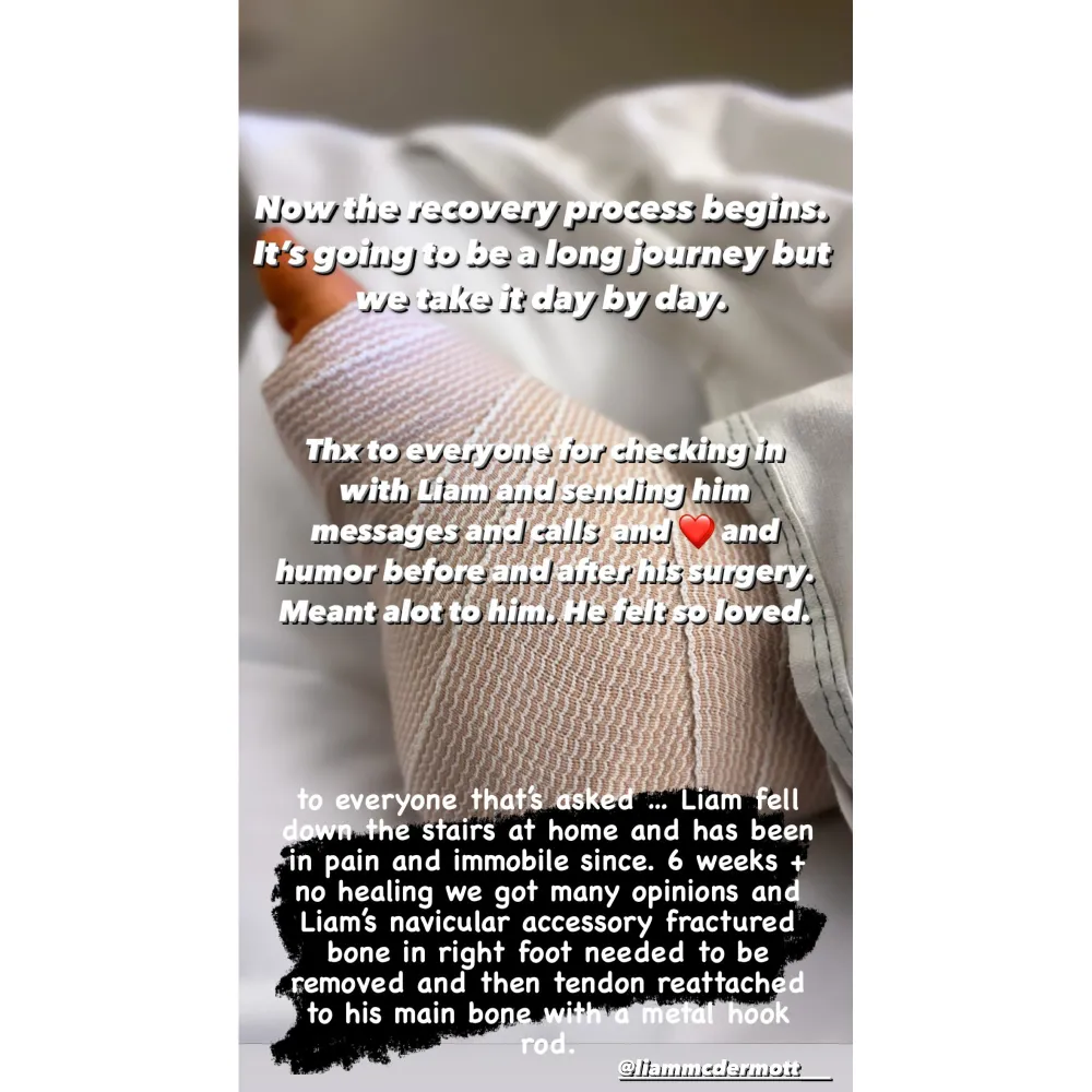 Tori Spelling Reveals Why Son Liam Had Foot Surgery