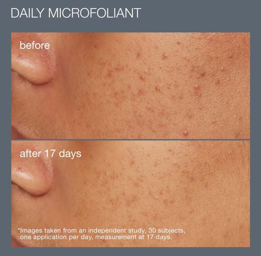 Dermalogica Best Cleanse + Glow Set