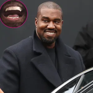 Kanye West Shows Off $850,000 Titanium Grill Inspired by James Bond Villain