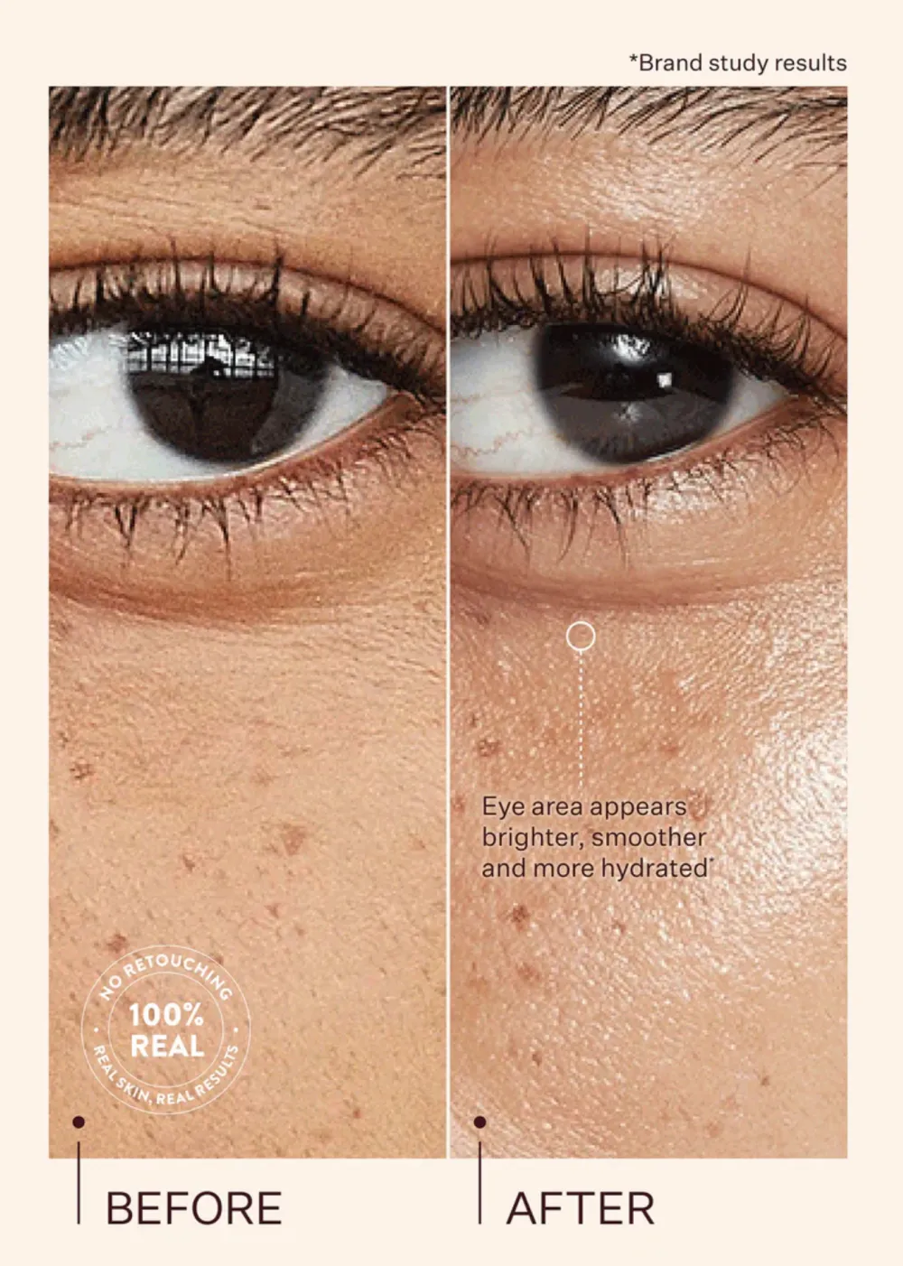 Brighten and Tighten Tired, Dehydrated Eyes With This Peach & Lily Favorite