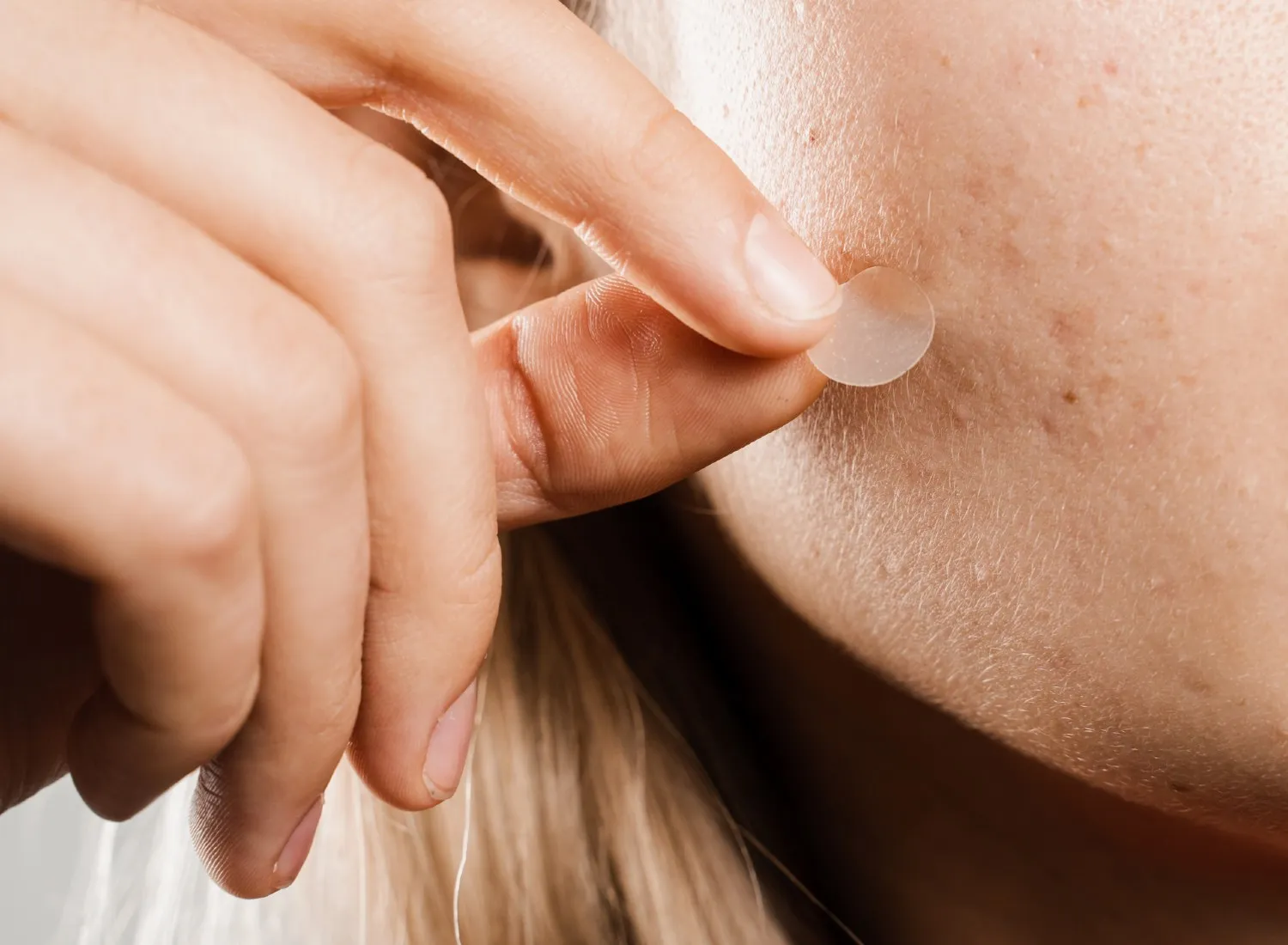 Woman removing a pimple patch