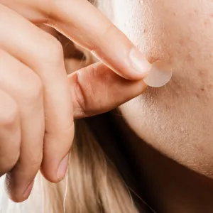 Woman removing a pimple patch